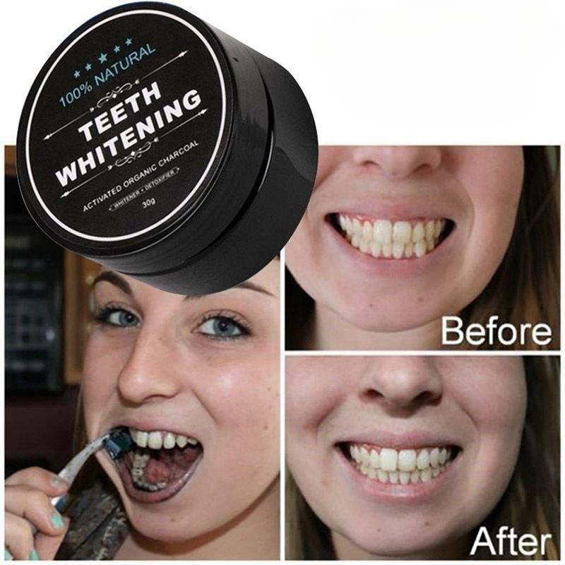 ผงฟอกสีฟันถ่านกัมมันต์ 1 กล่อง - Activated Charcoal Powder บทวิจารณ์และราคา